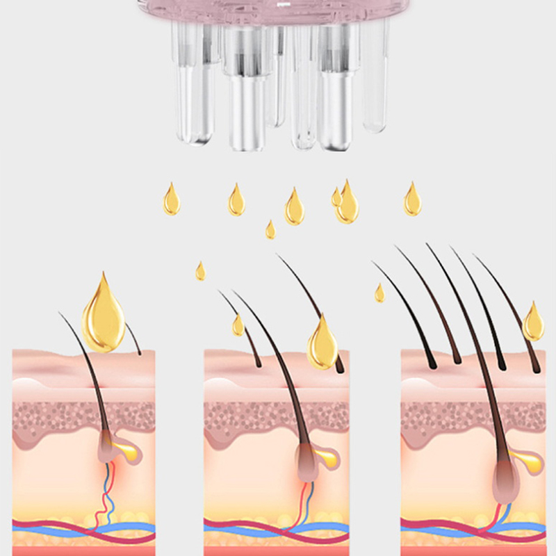 5ml 두피 어플리케이터 마사지 빗, 모발 성장 및 재 - Root Stimulator Liquid 리뷰 및 가격